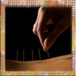 omeoroma-it-agopuntura-9